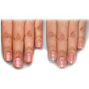 EVOY-Uñas Moldes poligel